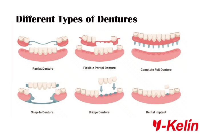 Different Types of Dentures