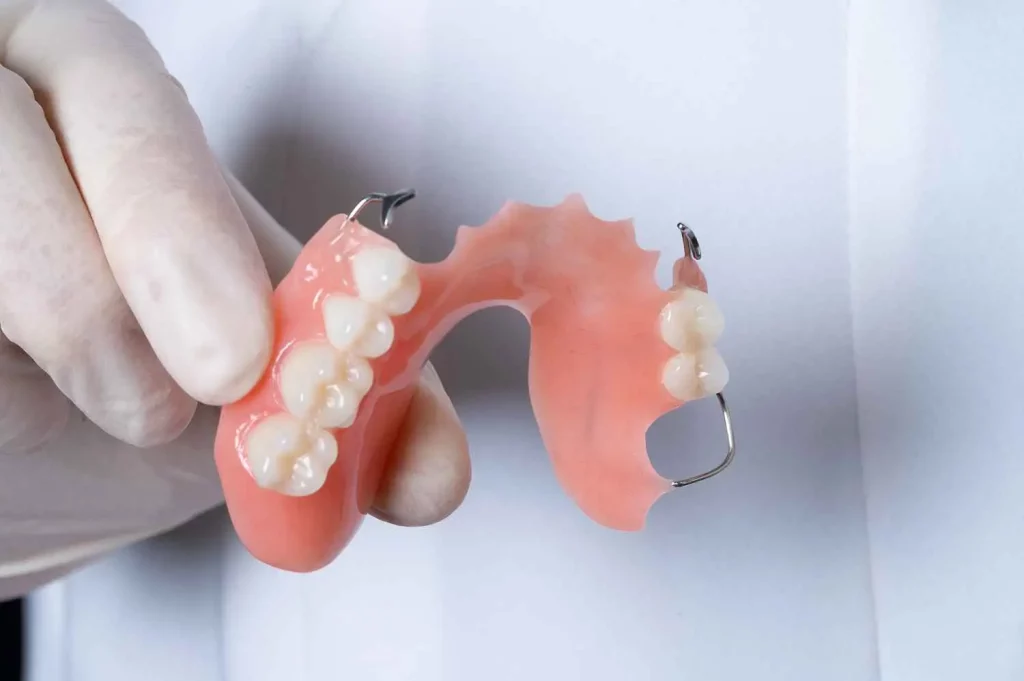 partial dentures