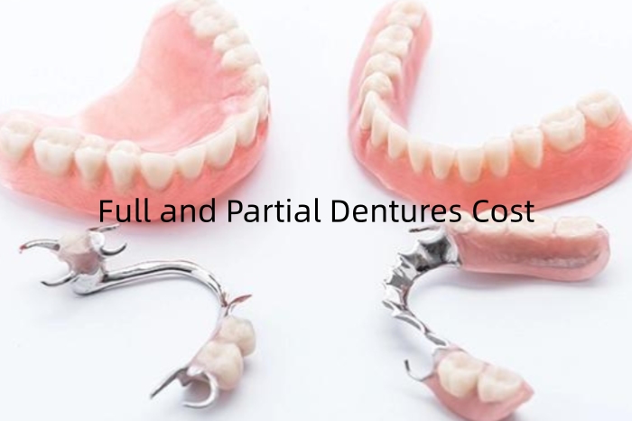 Full and Partial Dentures Cost